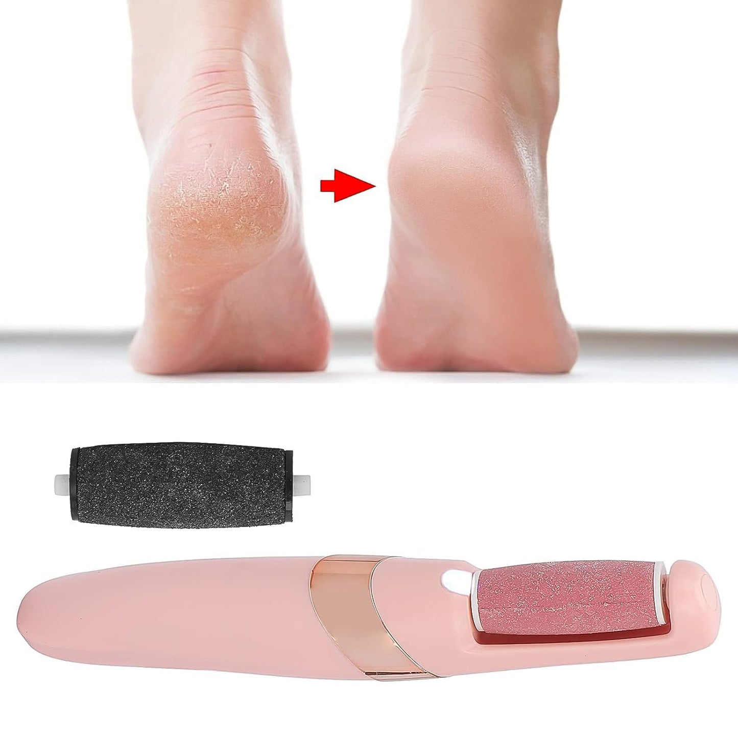 Flewless Pedi Electronic Pedicure Tool (1 Set) (X999)