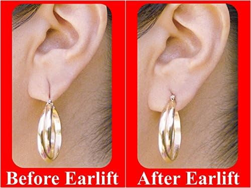 EAR LOBE SUPPORT PATCH (10*10 TOTAL 100 PATCHES)