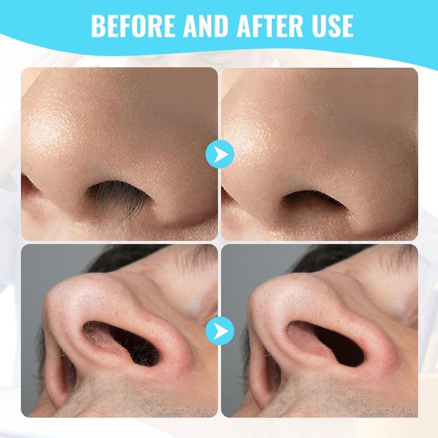 Nose Hair Removal Trimmer Nose Hair Remover Razor Kit Blade (3 Pcs Set) (X665)