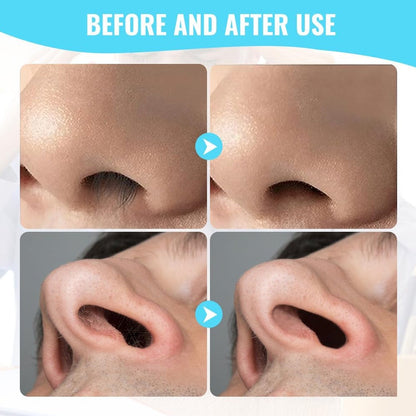 Nose Hair Removal Trimmer Nose Hair Remover Razor Kit Blade (3 Pcs Set) (X665)
