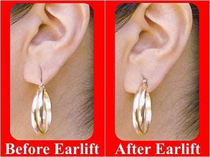 EAR LOBE SUPPORT PATCH (10*10 TOTAL 100 PATCHES)